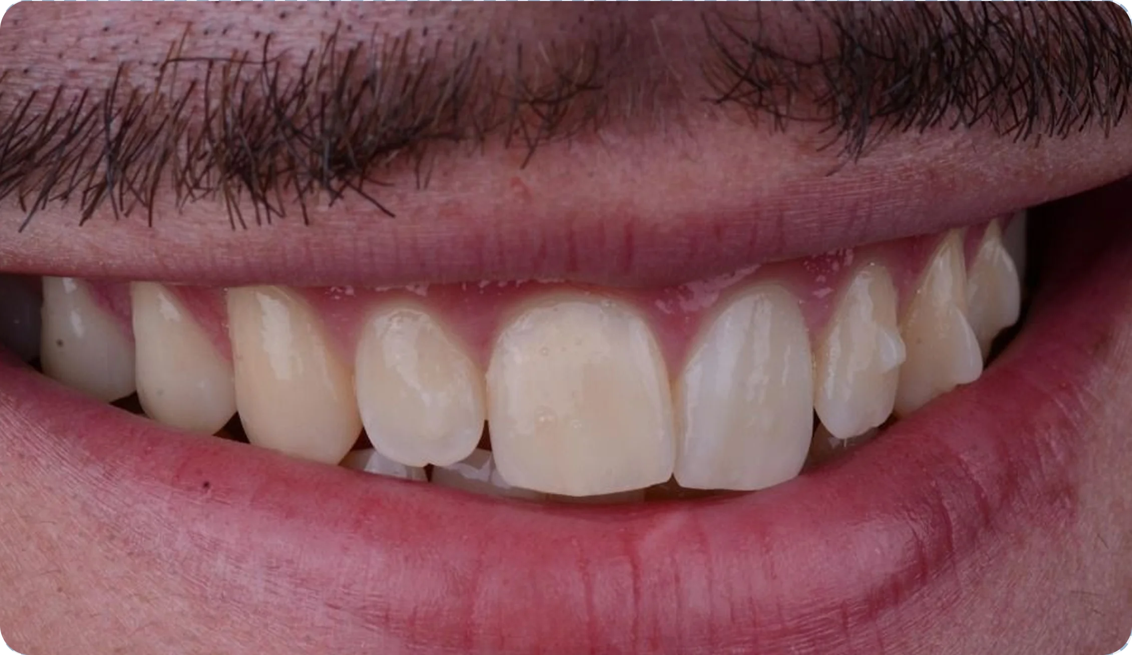 Routine_Dental_Check_image_6__1 Routine_Dental_Check_image_6__1