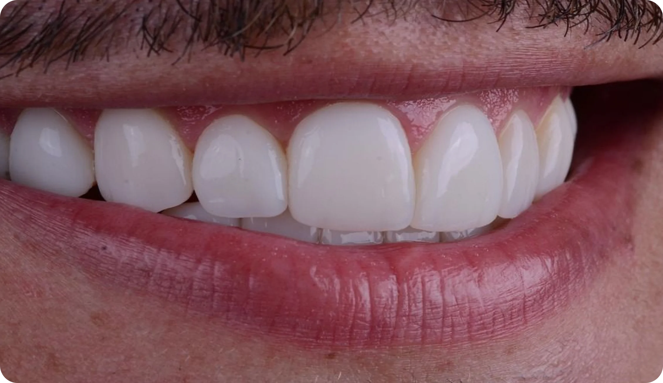 Routine_Dental_Check_image_7