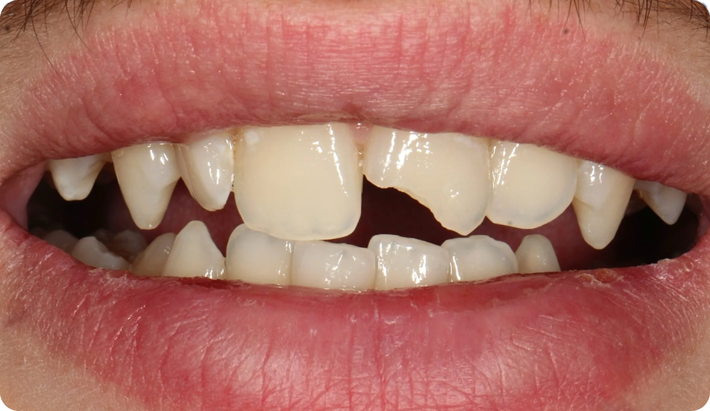 emergency-dentist_image_6