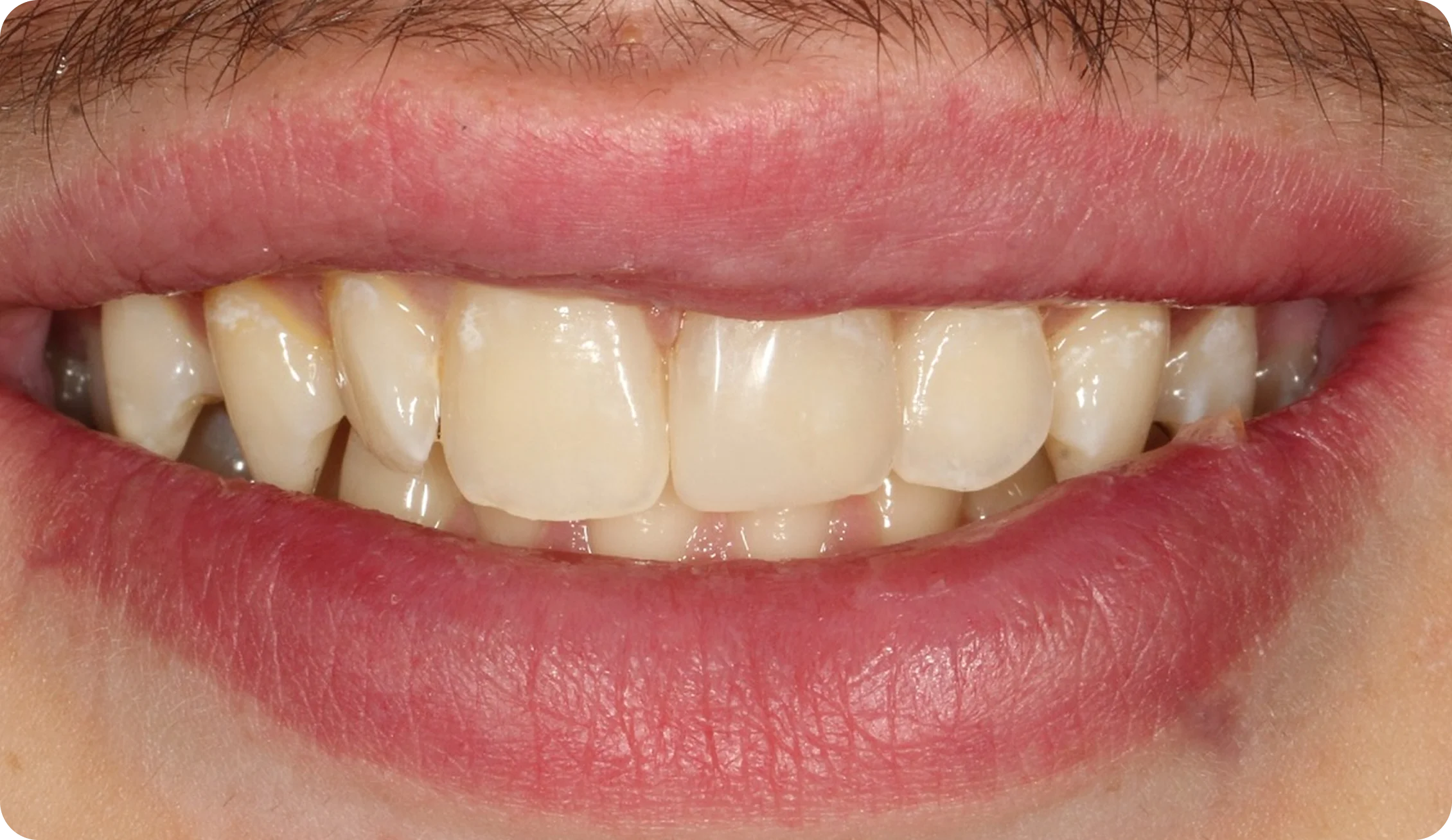 emergency-dentist_image_7