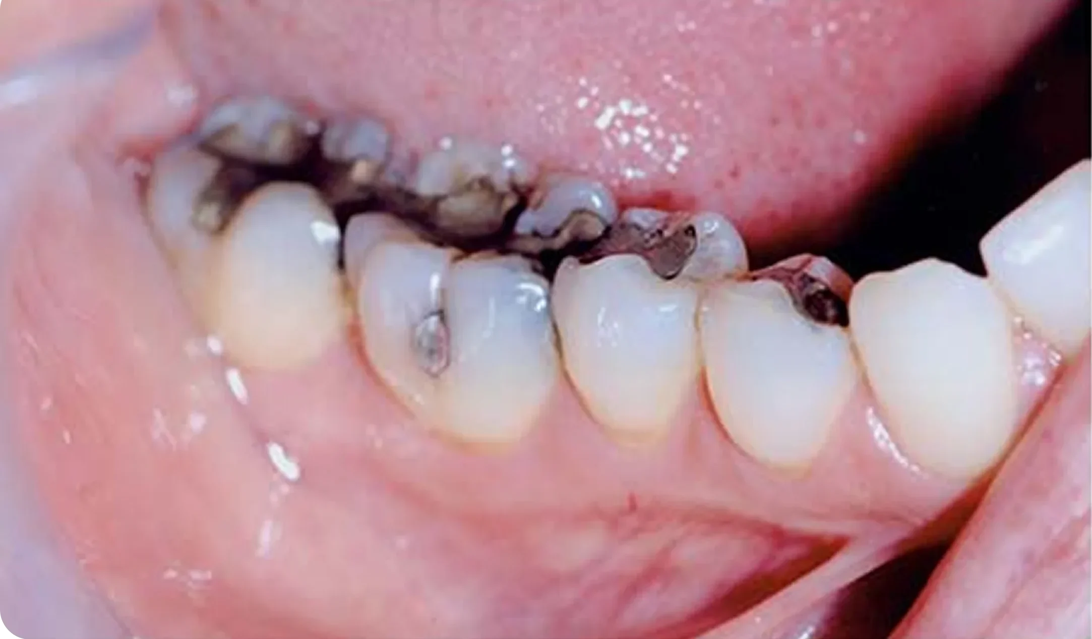 filling_Image_6
