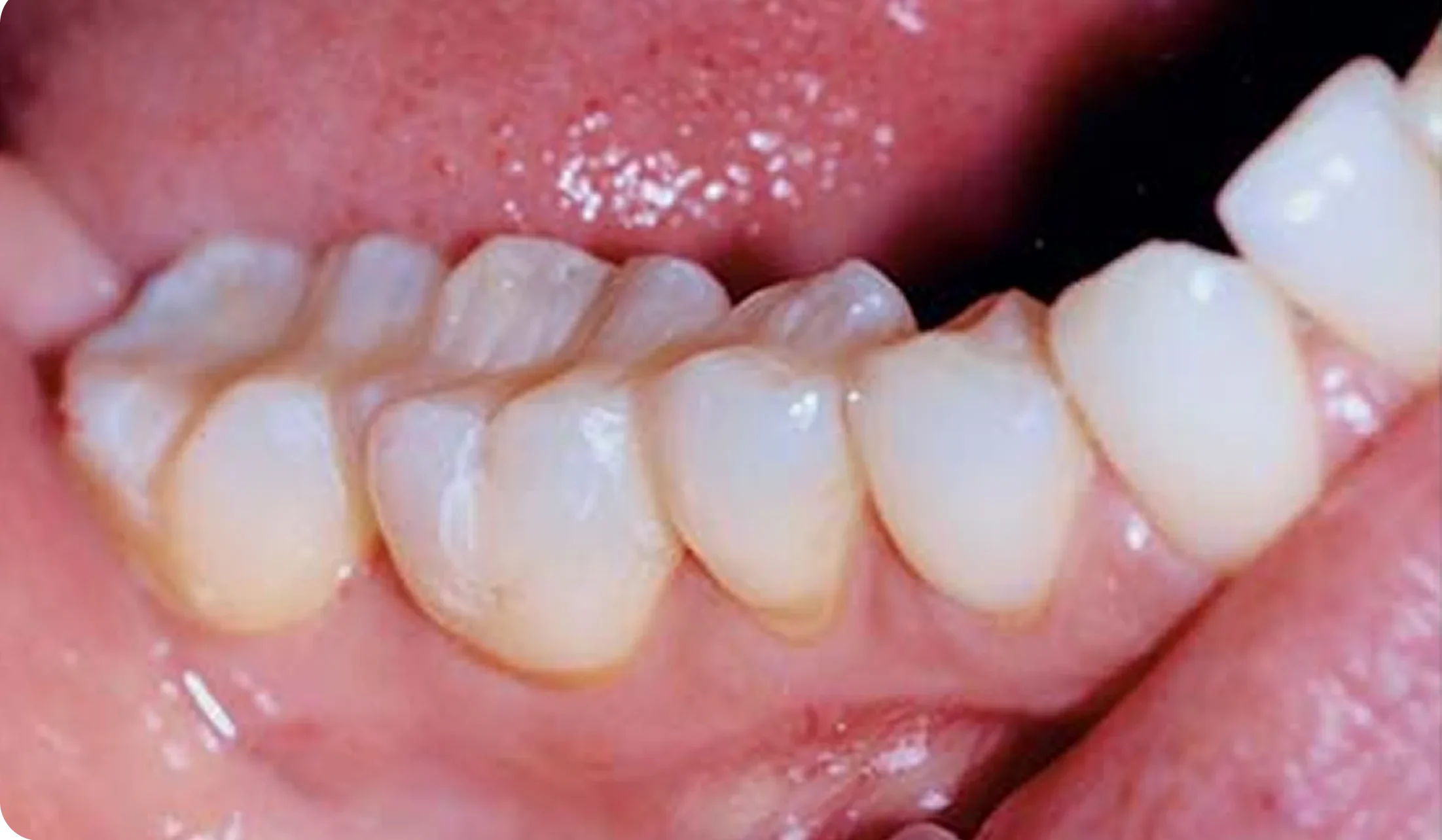 filling_Image_7